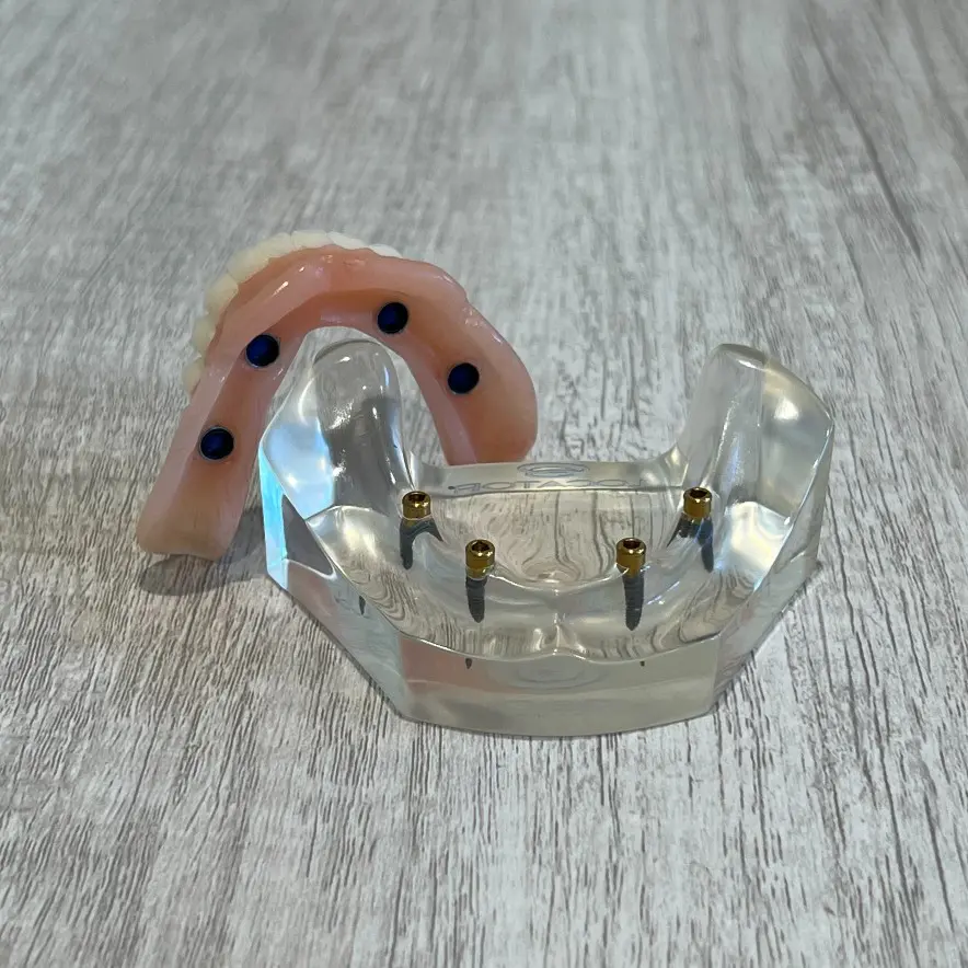 snap-in implant dentures Gallatin, TN